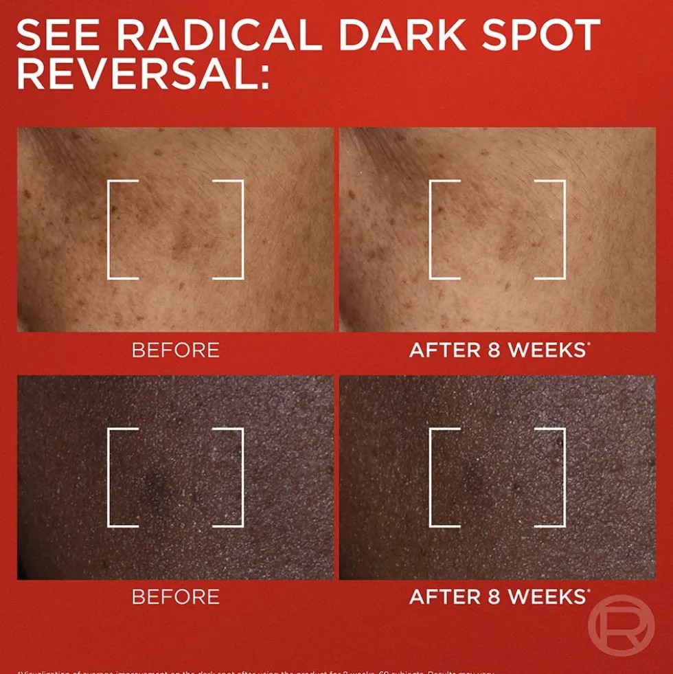 Triple Power Melasyl Dark Spot Creamy Serum for Darks Spots and Wrinkles